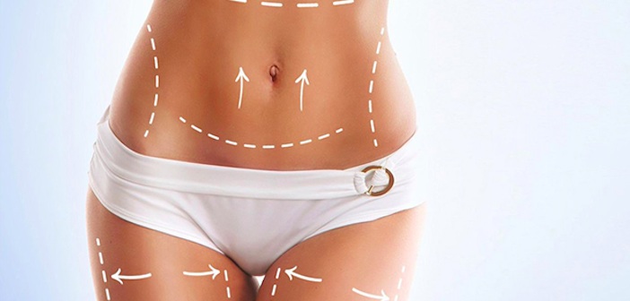 İnatçı Kilolara Veda Etmenin Mucizevi Formülü: Liposuction