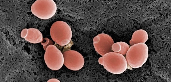 Candida Diyeti Nedir? Candida Diyeti Nasıl Yapılır?