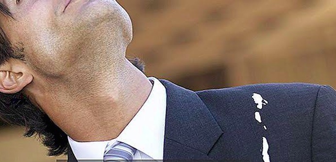 Giysilerden Kuş Pislikleri Nasıl Çıkarılır?